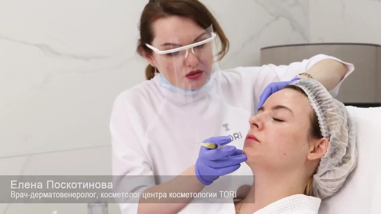 лечение акне плазмотерапией